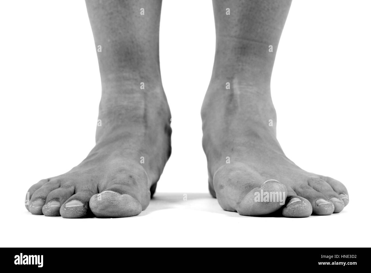 Close up de pieds avec les oignons Banque D'Images