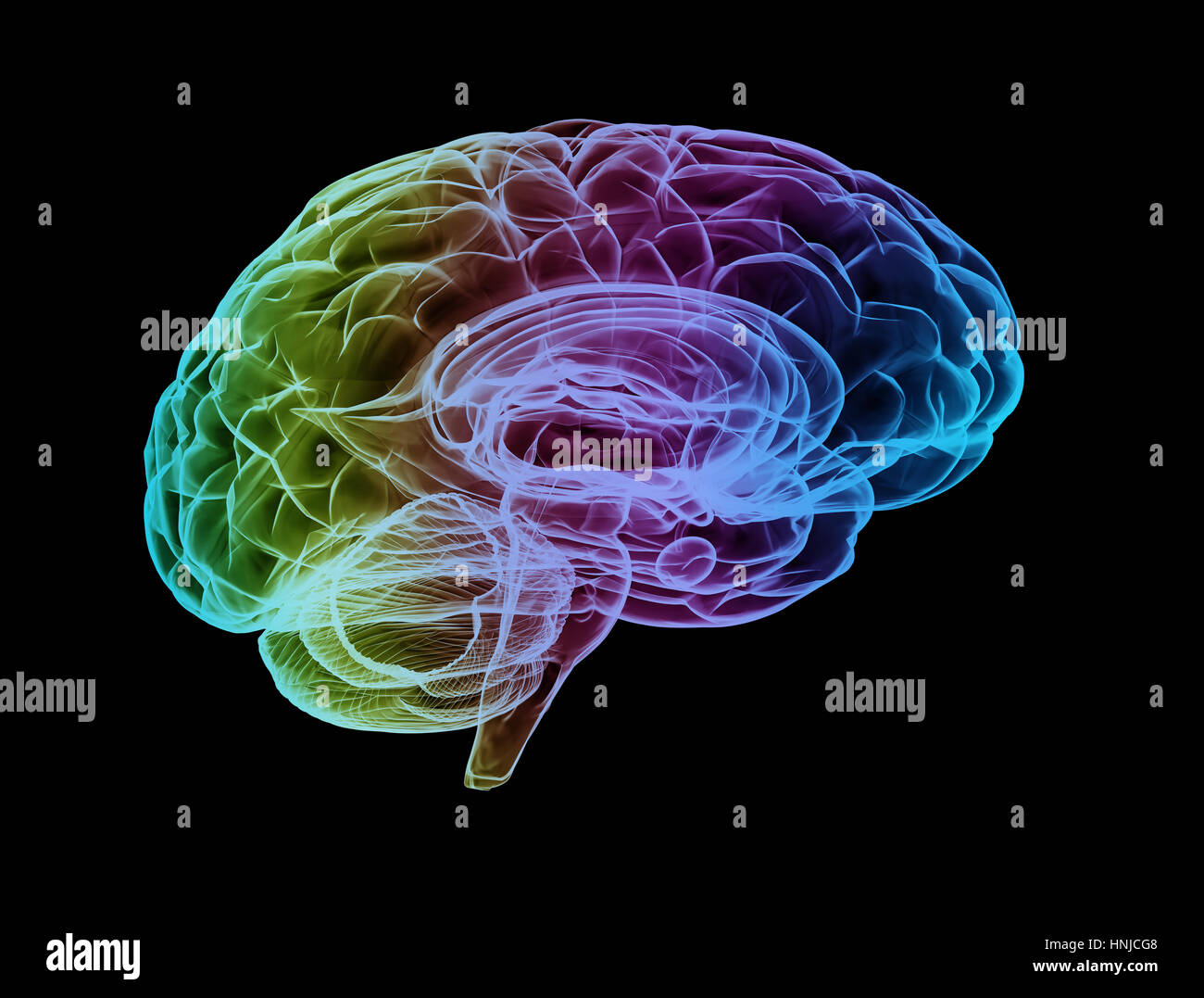 Cerveau humain multi couleur image rayon x Banque D'Images