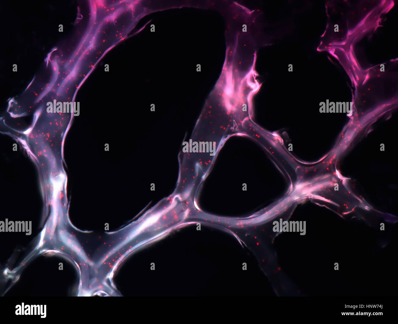 Les nanoparticules auto-assemblées exerçant son micro RNAs de tumeur du sein dans un modèle de souris et coller à la cible tumorale Banque D'Images