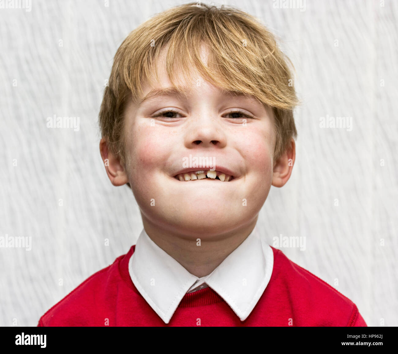 L'éruption des dents permanentes dans un garçon de huit ans Banque D'Images
