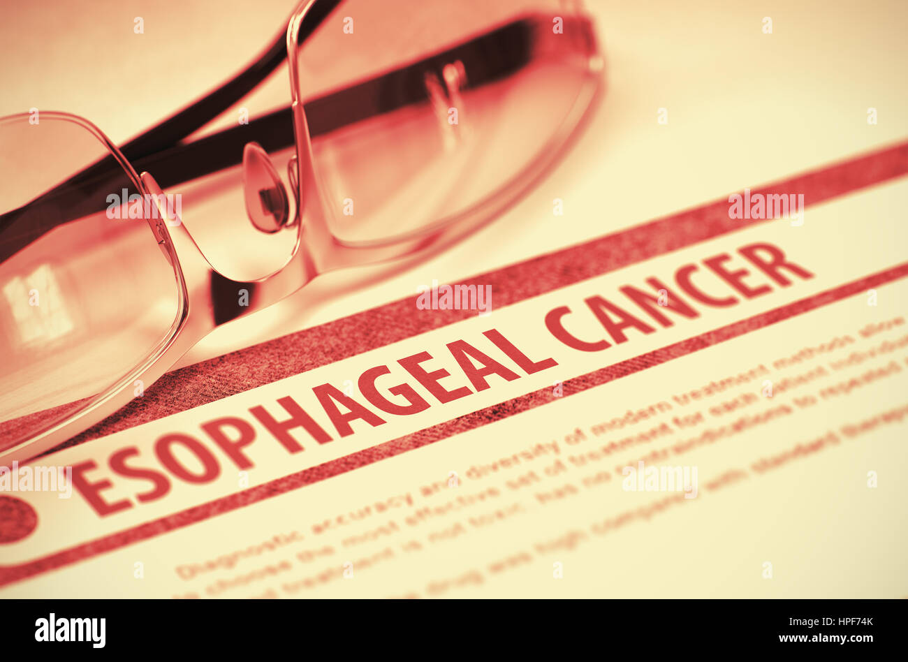 - Diagnostic du cancer de l'Œsophage. Medicine Concept sur fond rouge avec texte estompé et paire de lunettes. Focus sélectif. Le Rendu 3D. Banque D'Images