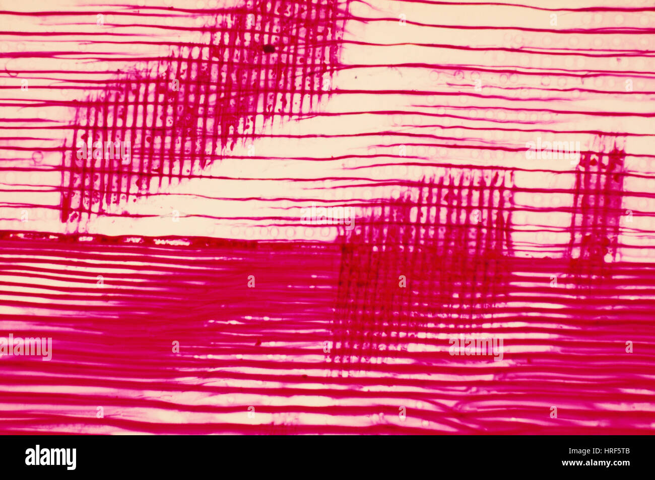 Rayons médullaires Banque D'Images