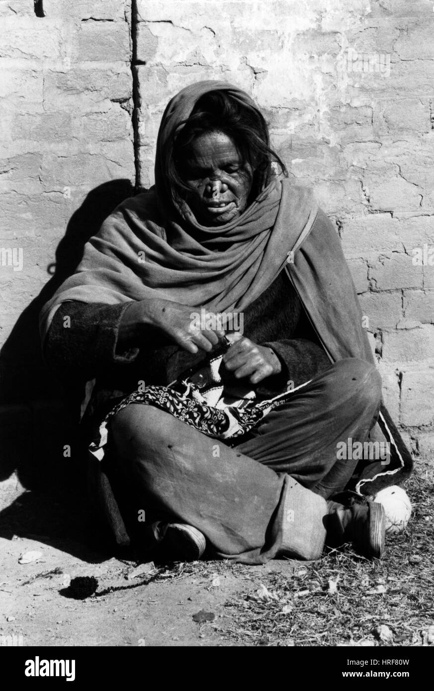 Femme avec la lèpre Banque D'Images
