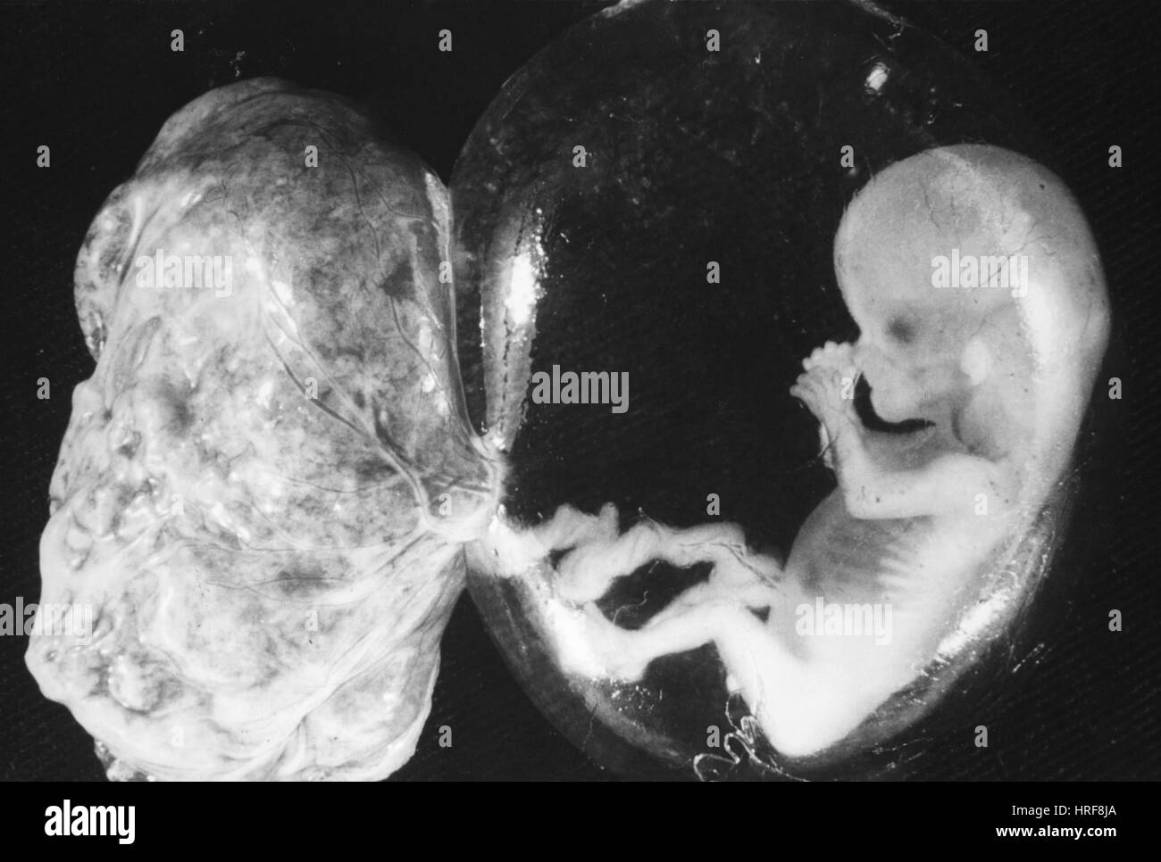Fœtus humain Banque D'Images