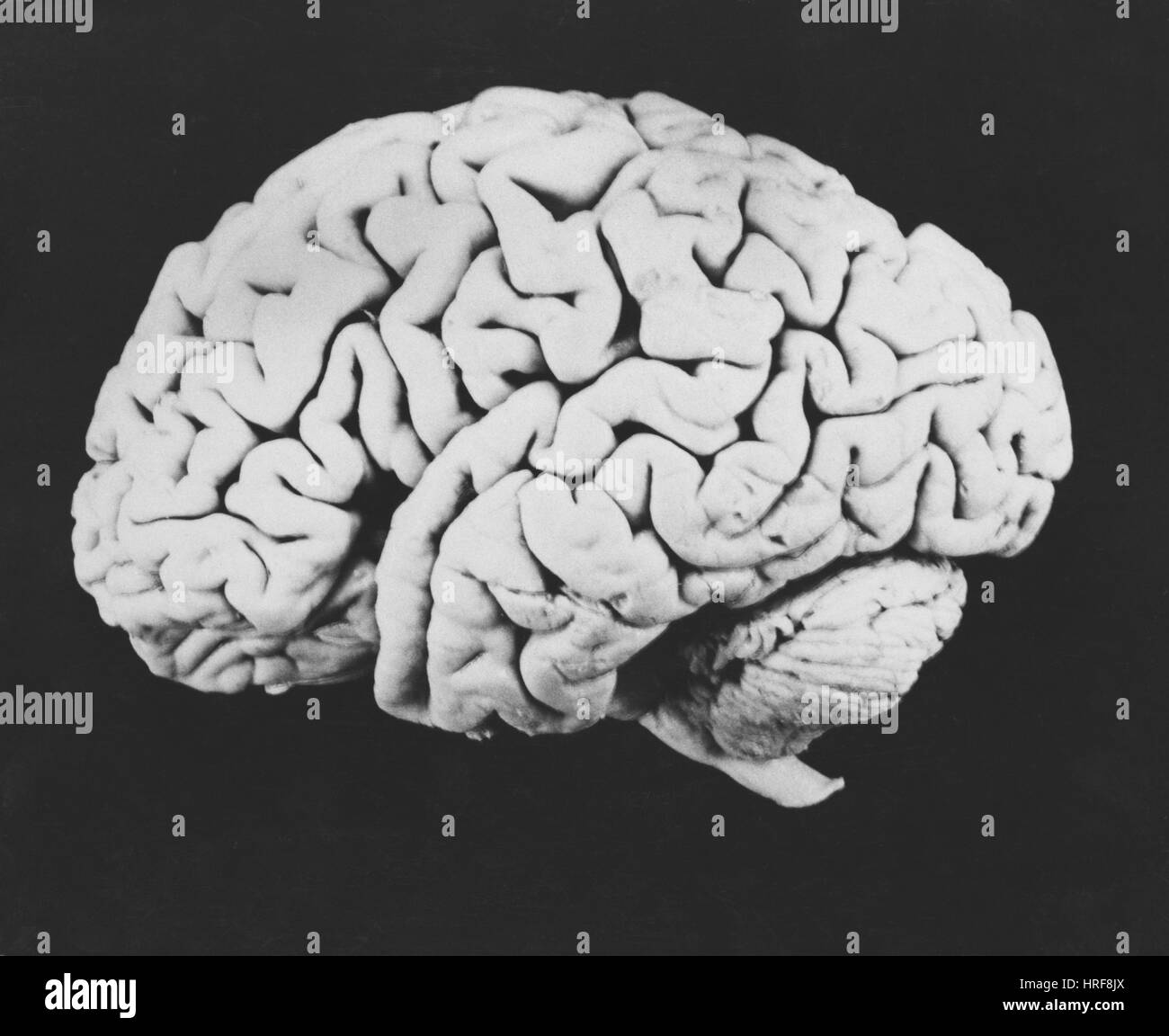 Cerveau humain Banque D'Images