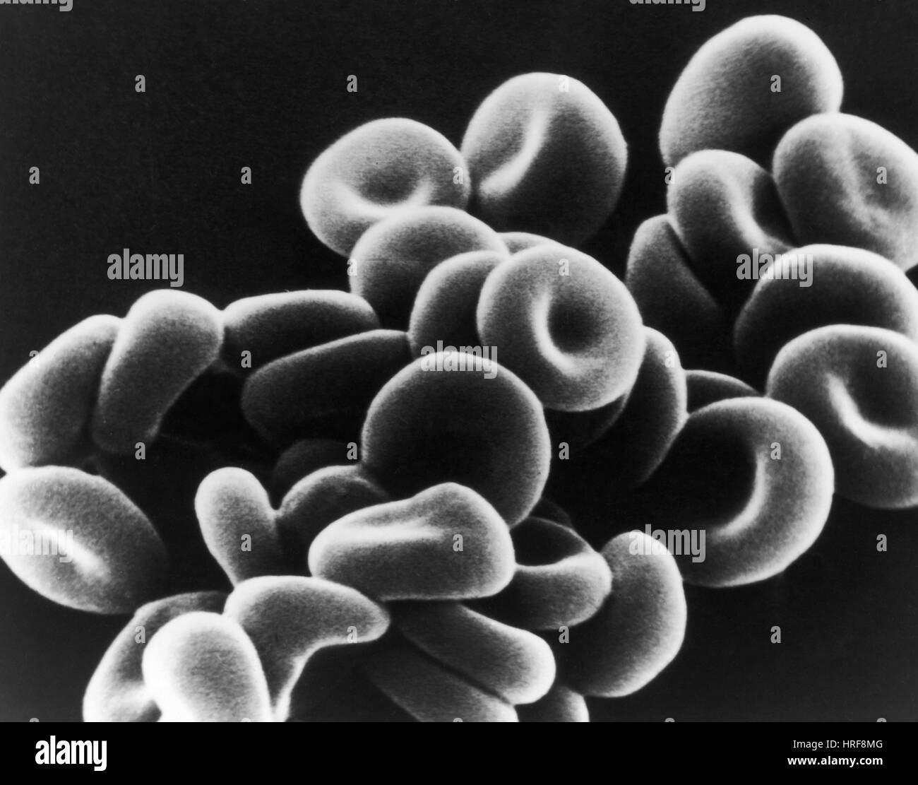 Scanning electron microscopy cell Banque d'images noir et blanc - Alamy