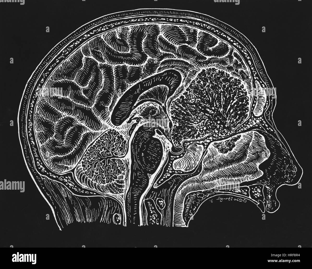 La section transversale du cerveau, Banque D'Images