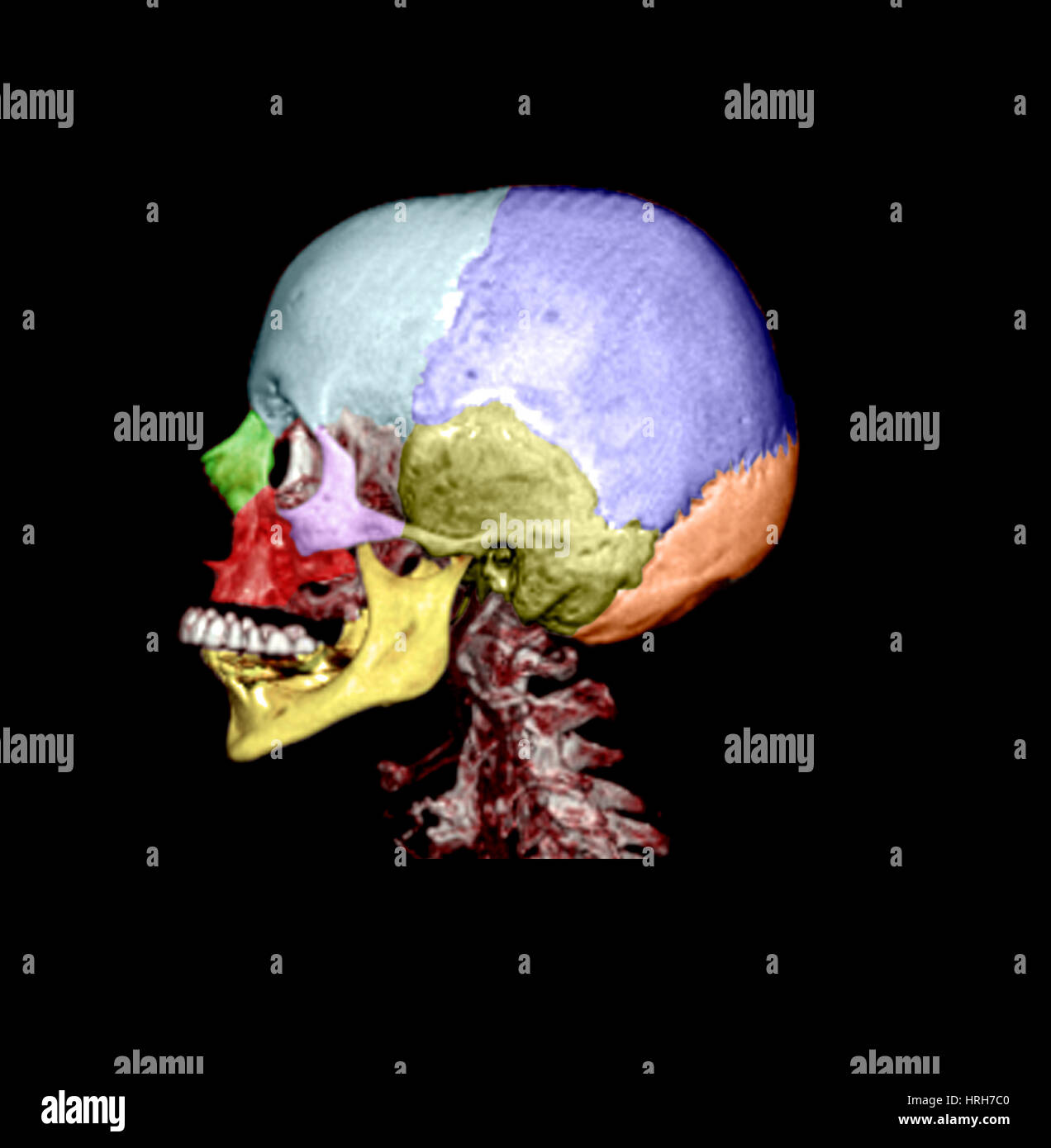 Crâne humain Banque D'Images
