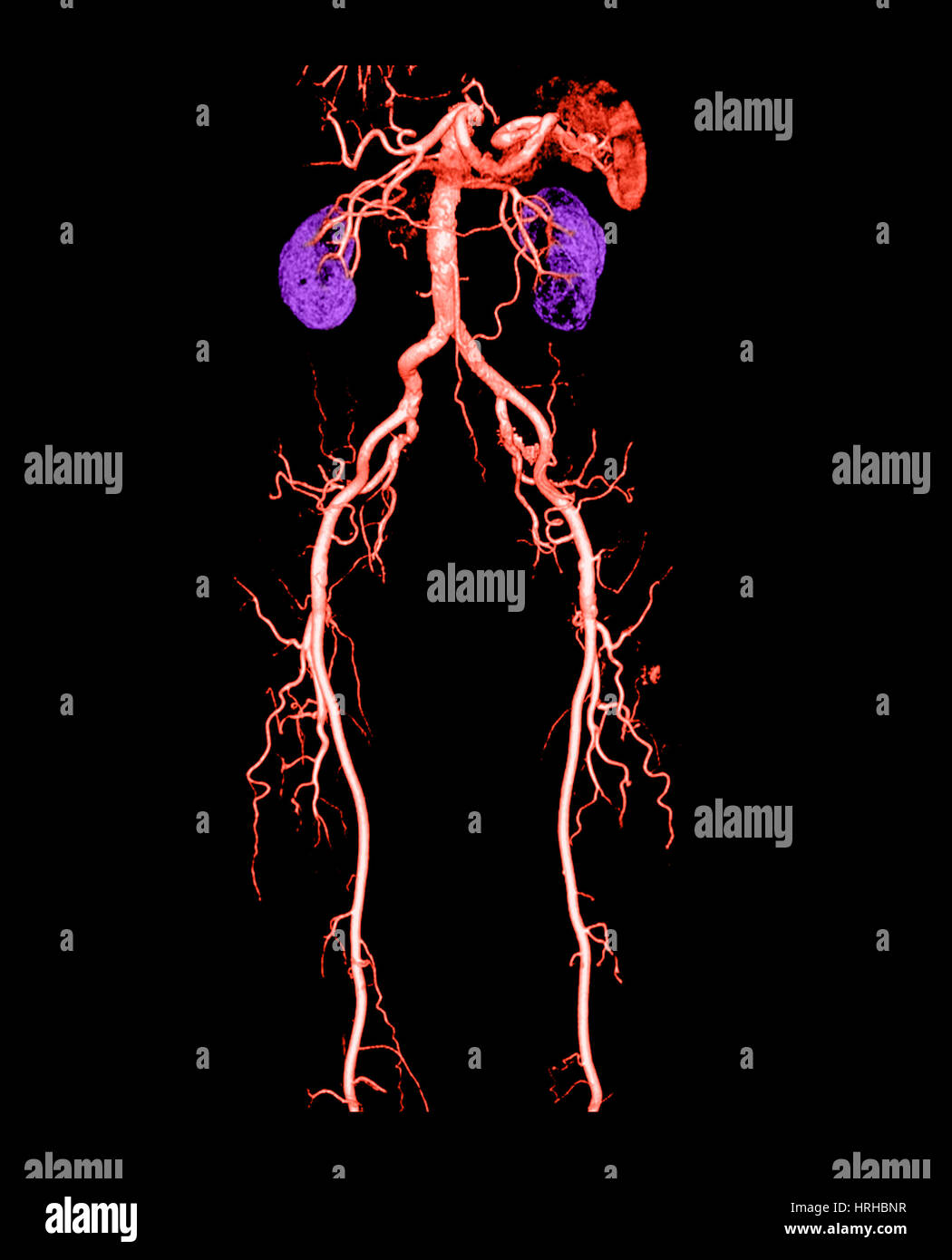 Abdominal ct scan abdomen Banque de photographies et d’images à haute résolution Alamy