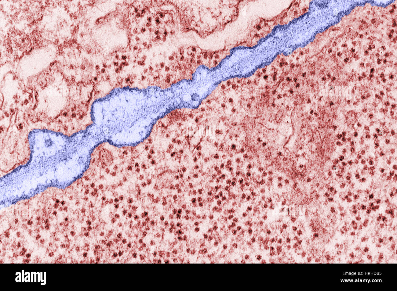 TEM la membrane plasmique Banque D'Images