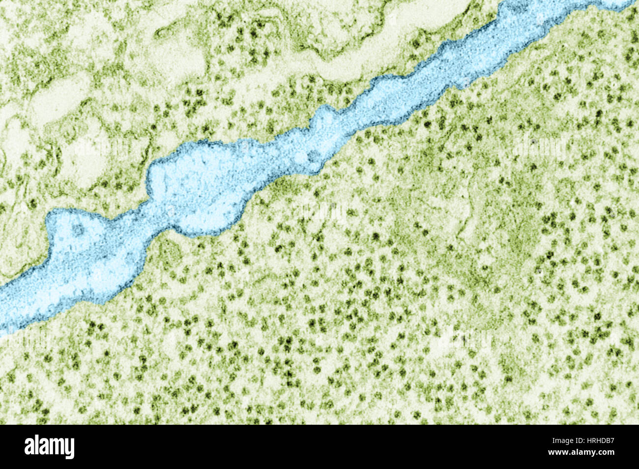 TEM la membrane plasmique Banque D'Images