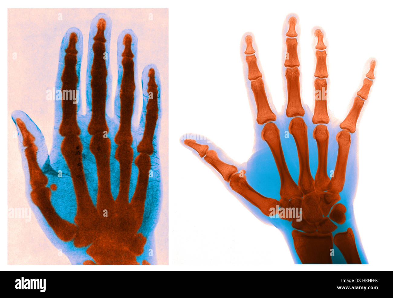 Main anciens et modernes des rayons X Banque D'Images