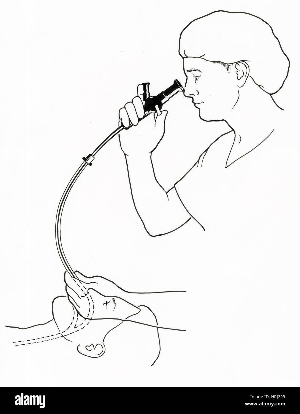 Illustration de l'endoscopie Banque D'Images