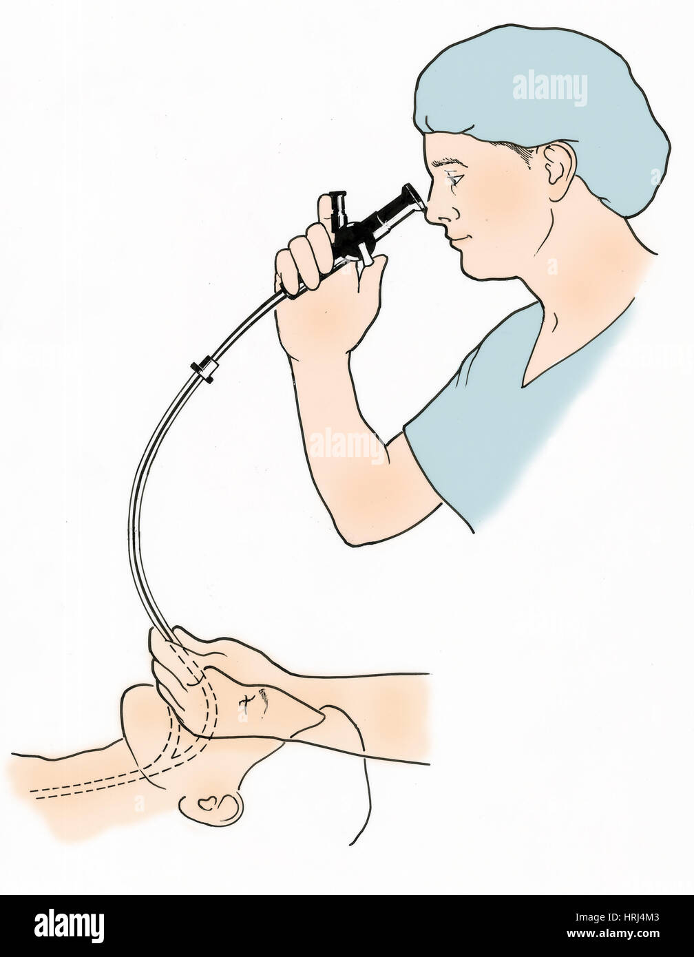 Illustration de l'endoscopie Banque D'Images
