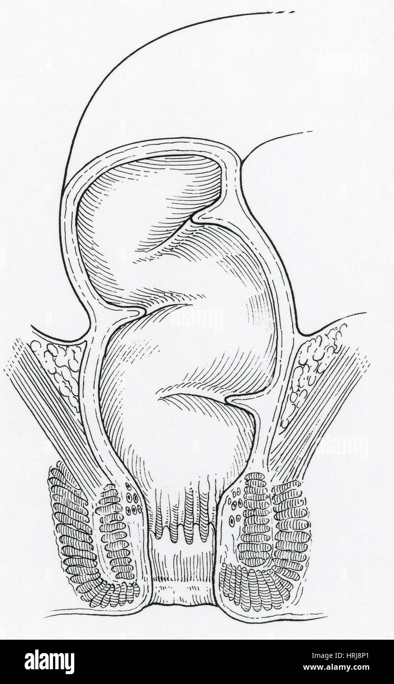 Diagram of the rectum and anus Banque de photographies et d’images à haute résolution Alamy