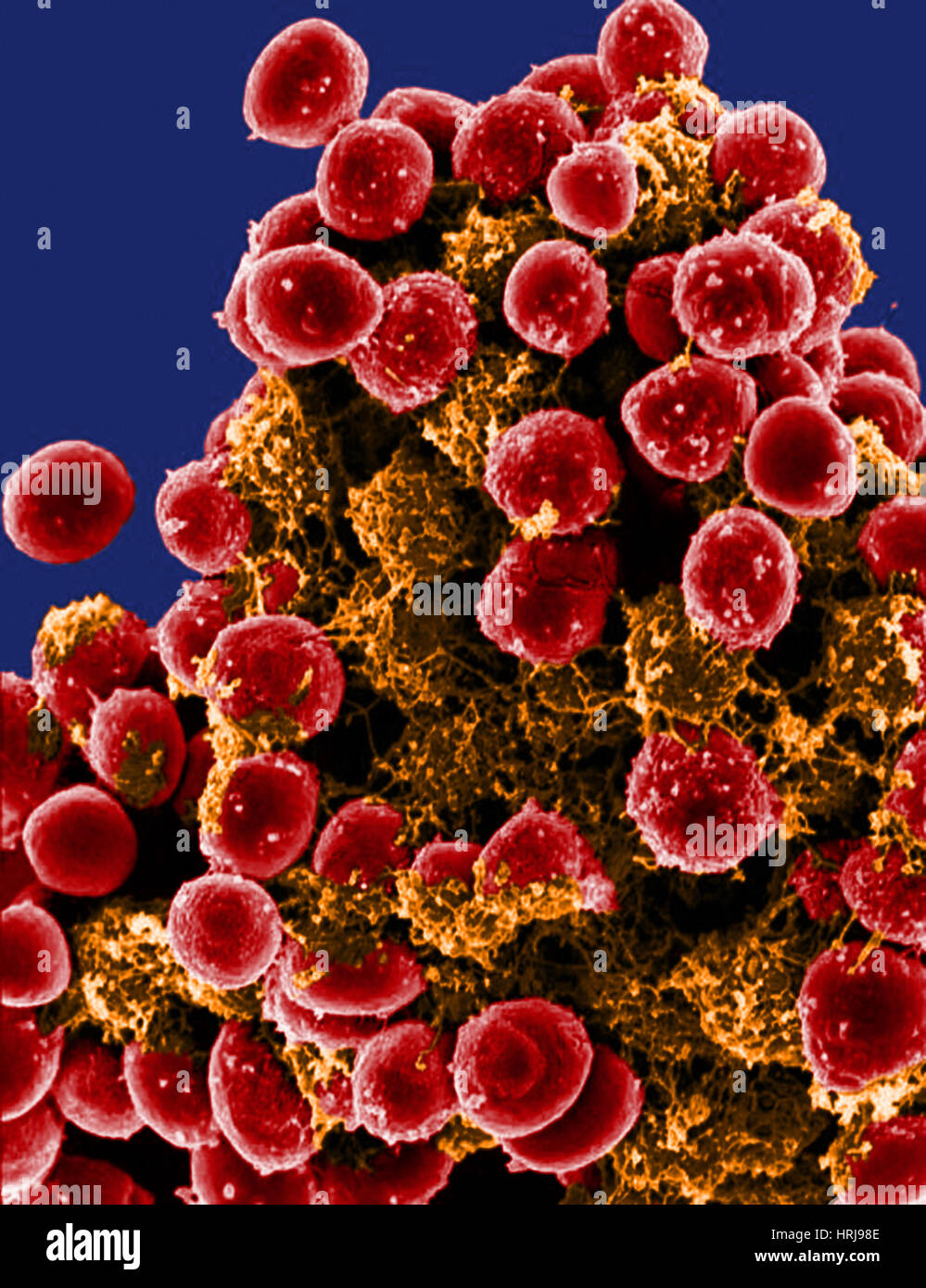 Les bactéries Staphylococcus epidermidis, SEM Banque D'Images