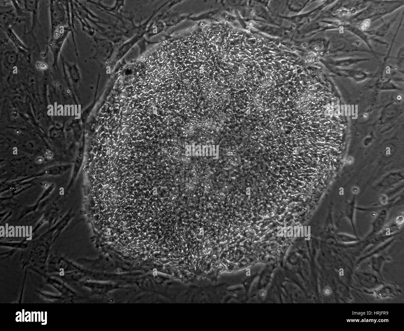 Lignée de cellules souches embryonnaires humaines BG02 Banque D'Images