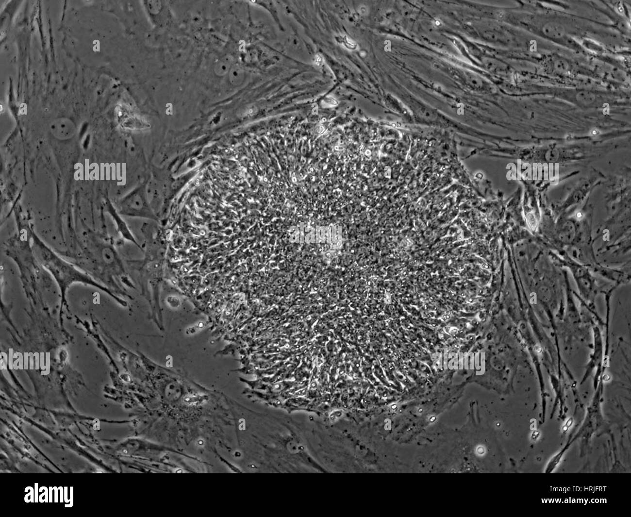 Lignée de cellules souches embryonnaires humaines TE03 Banque D'Images