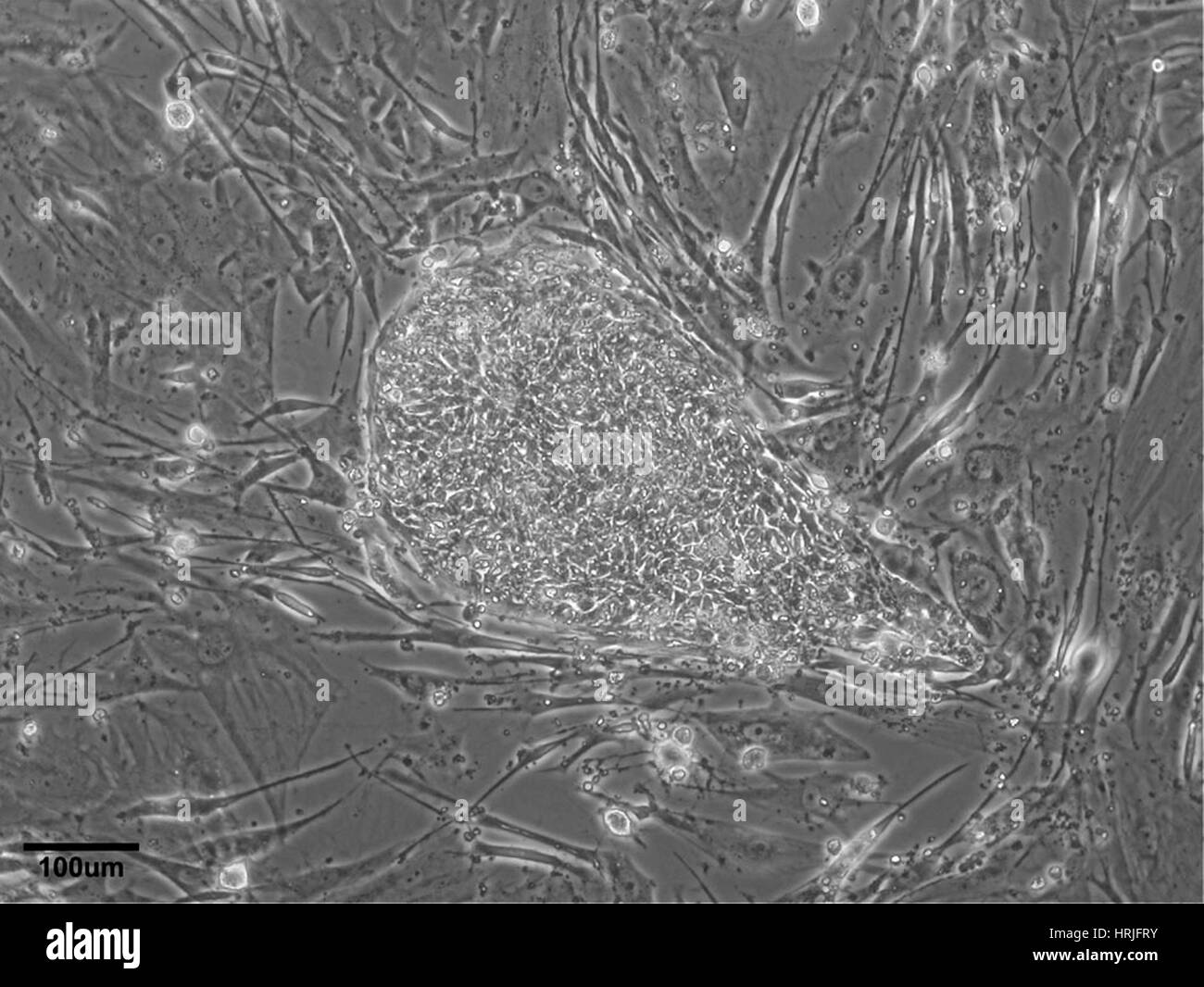 Lignée de cellules souches embryonnaires humaines WA01 Banque D'Images