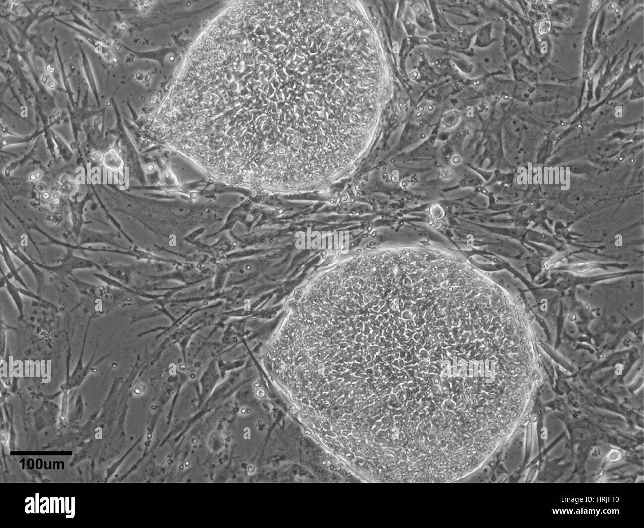 Lignée de cellules souches embryonnaires humaines WA07 Banque D'Images