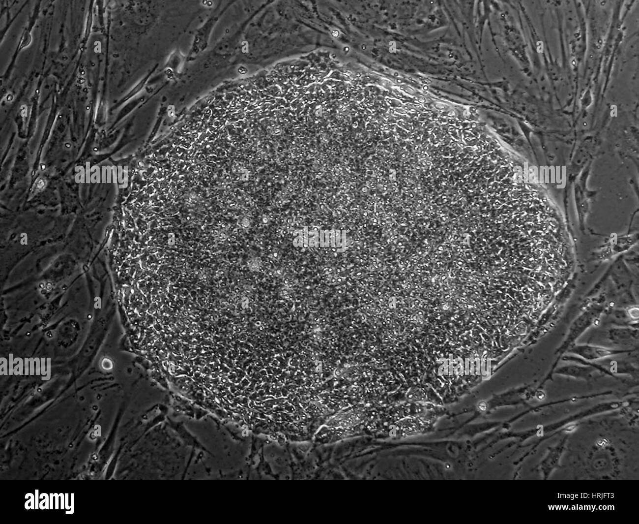 Lignée de cellules souches embryonnaires humaines WA13 Banque D'Images