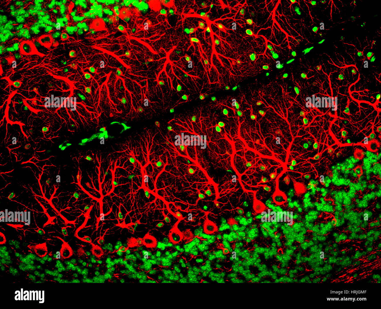 Les cellules de Purkinje, fluorescentes LM Banque D'Images