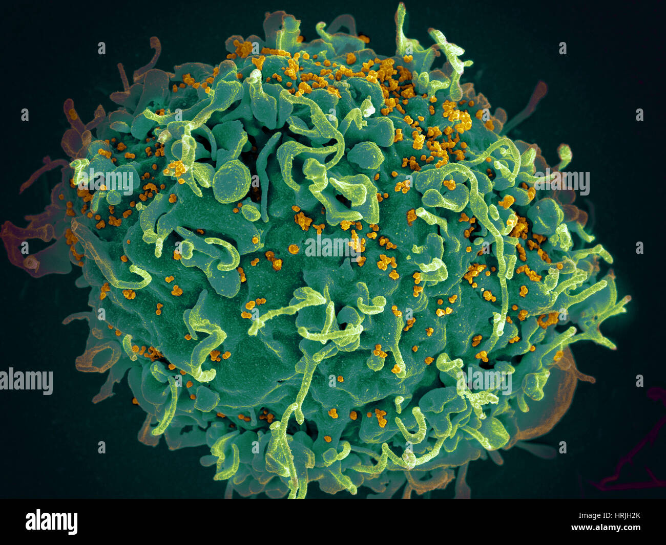 Le VIH, T cell sous attaque, SEM Banque D'Images