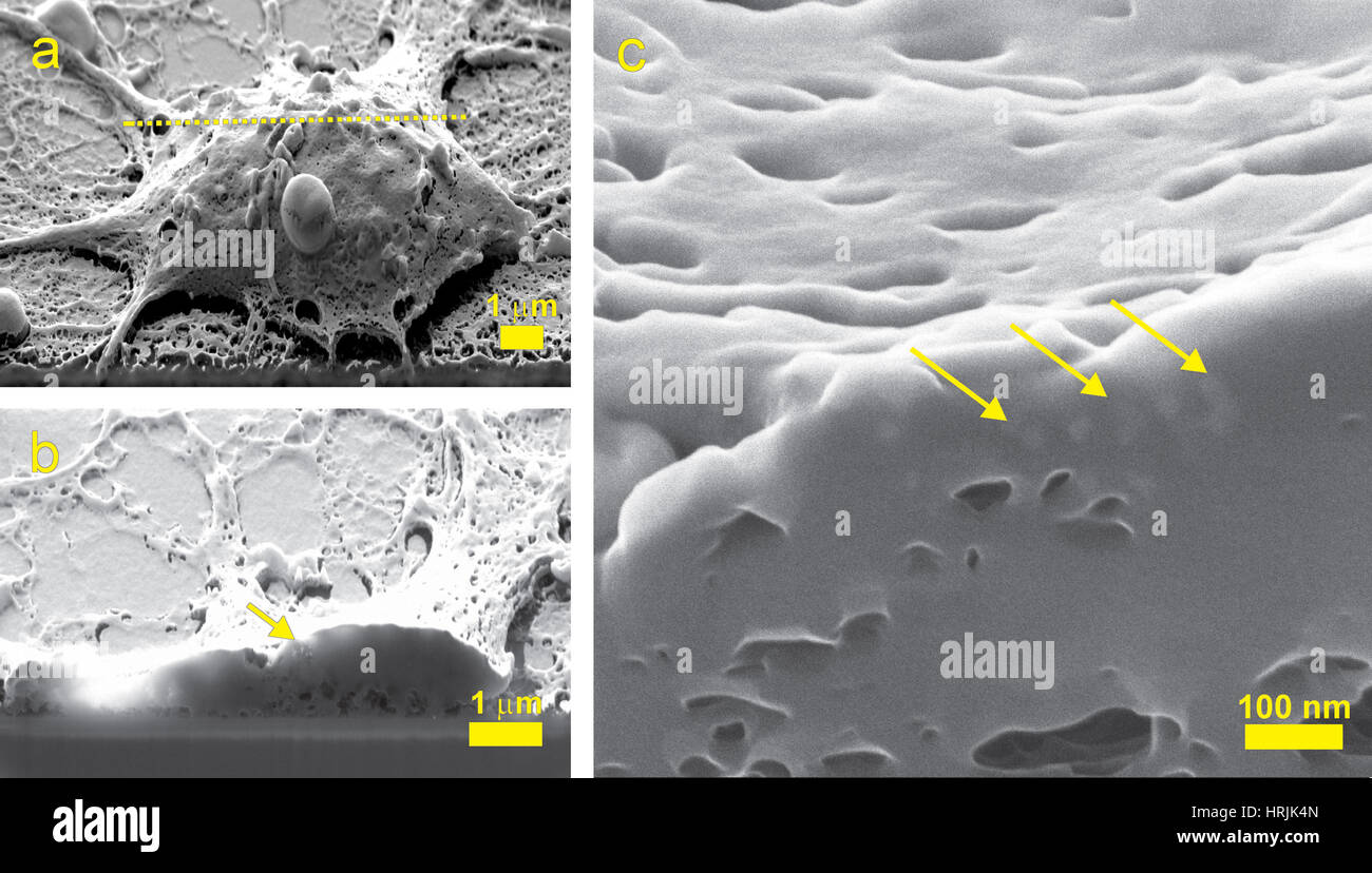 Des cellules neurales, nanoparticules, la cale Banque D'Images