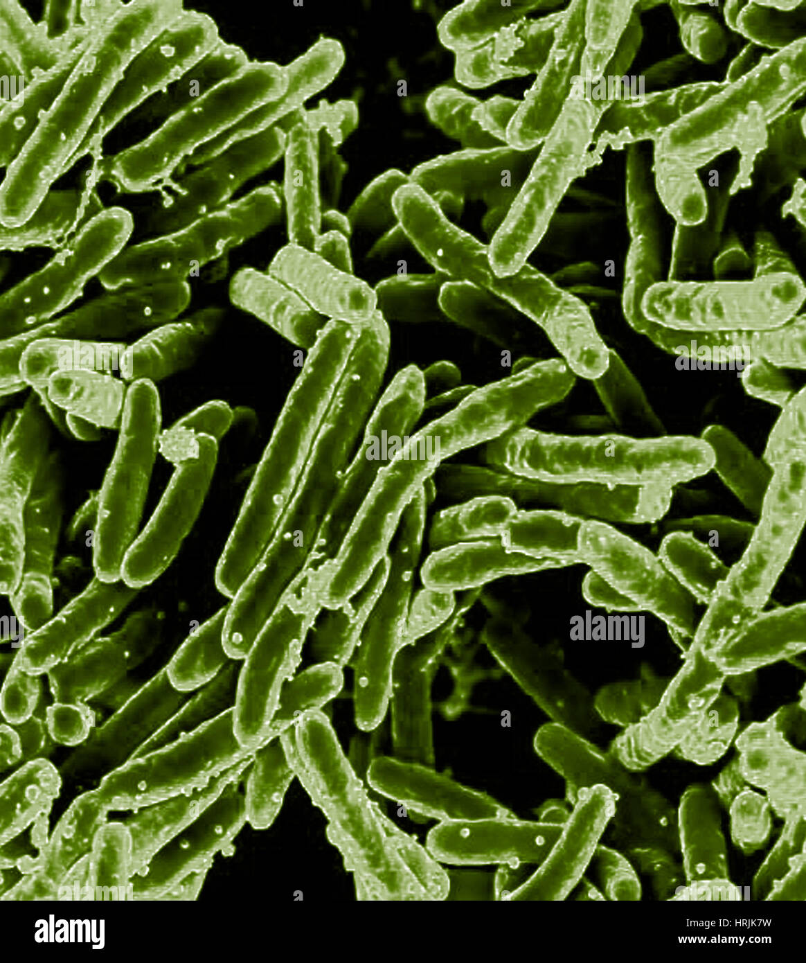 La bactérie Mycobacterium tuberculosis, SEM Banque D'Images