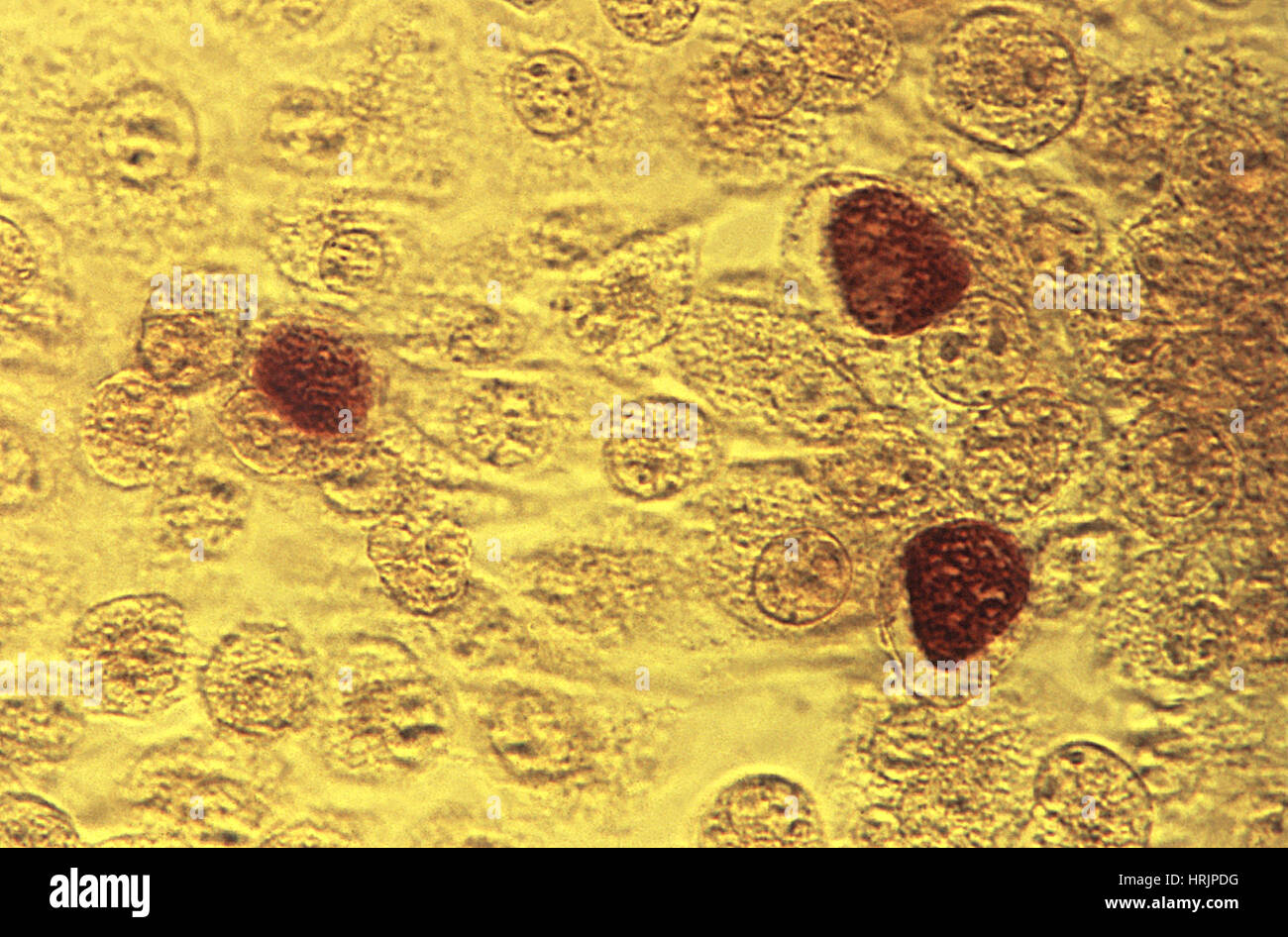 La bactérie Chlamydia trachomatis, LM Banque D'Images