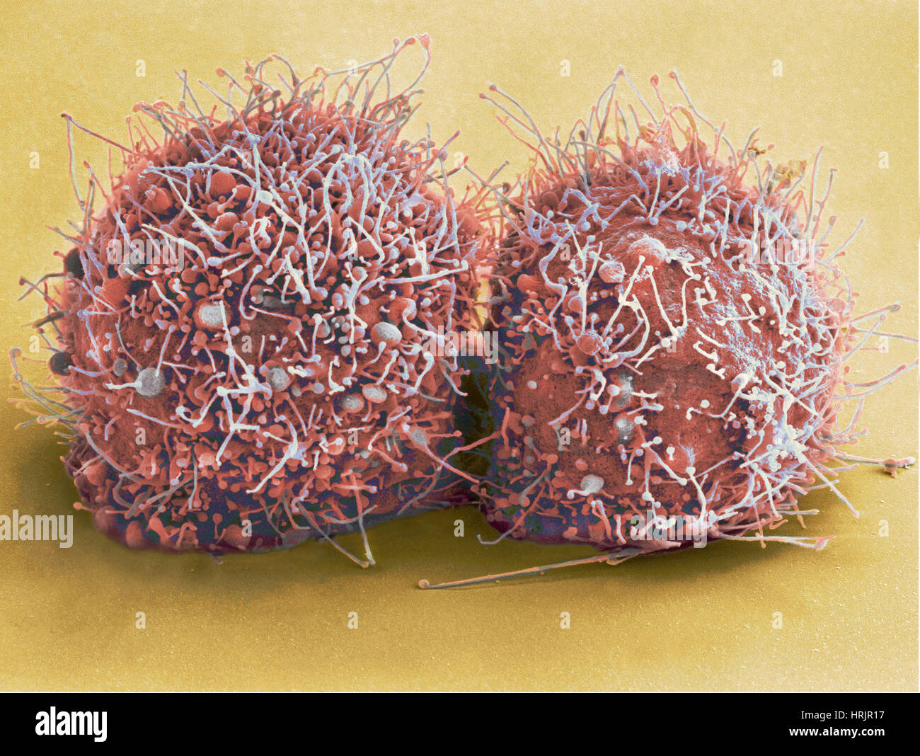 La division de cellules HeLa, SEM Banque D'Images