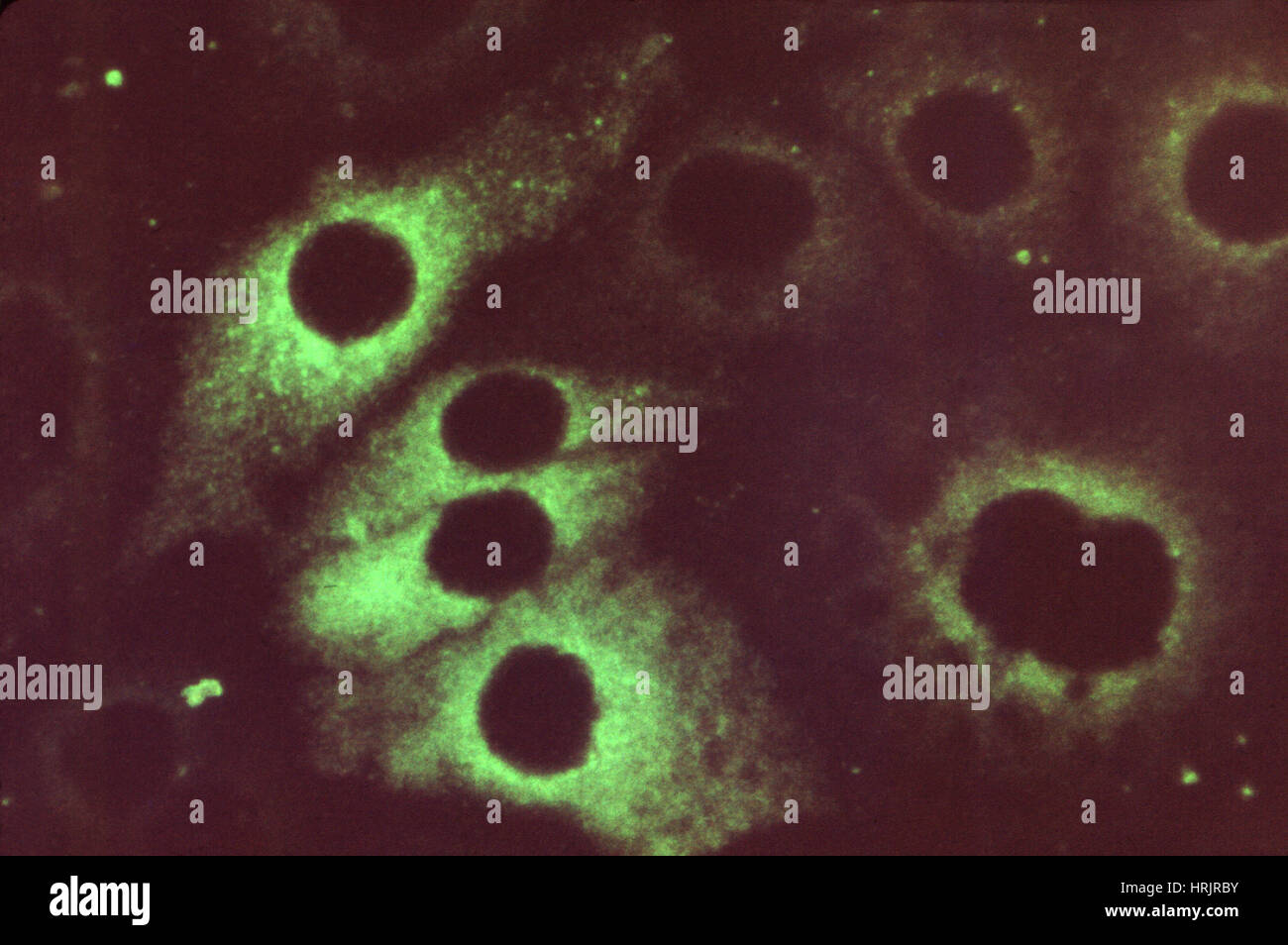 Le virus de la rubéole, la rougeole, la technique de FA Banque D'Images