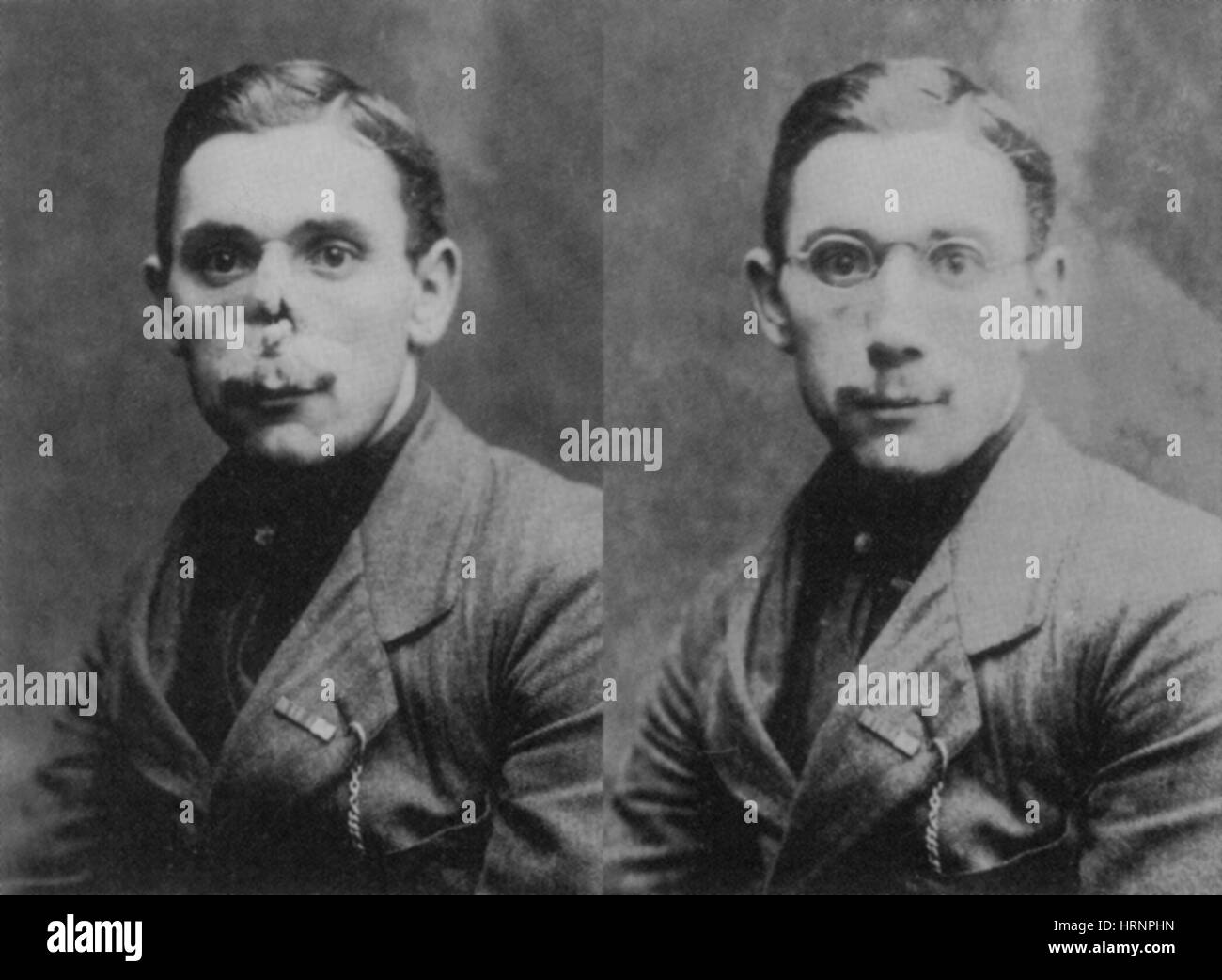 "Soldat", avant et après le port de masque Anna Coleman Ladd Banque D'Images