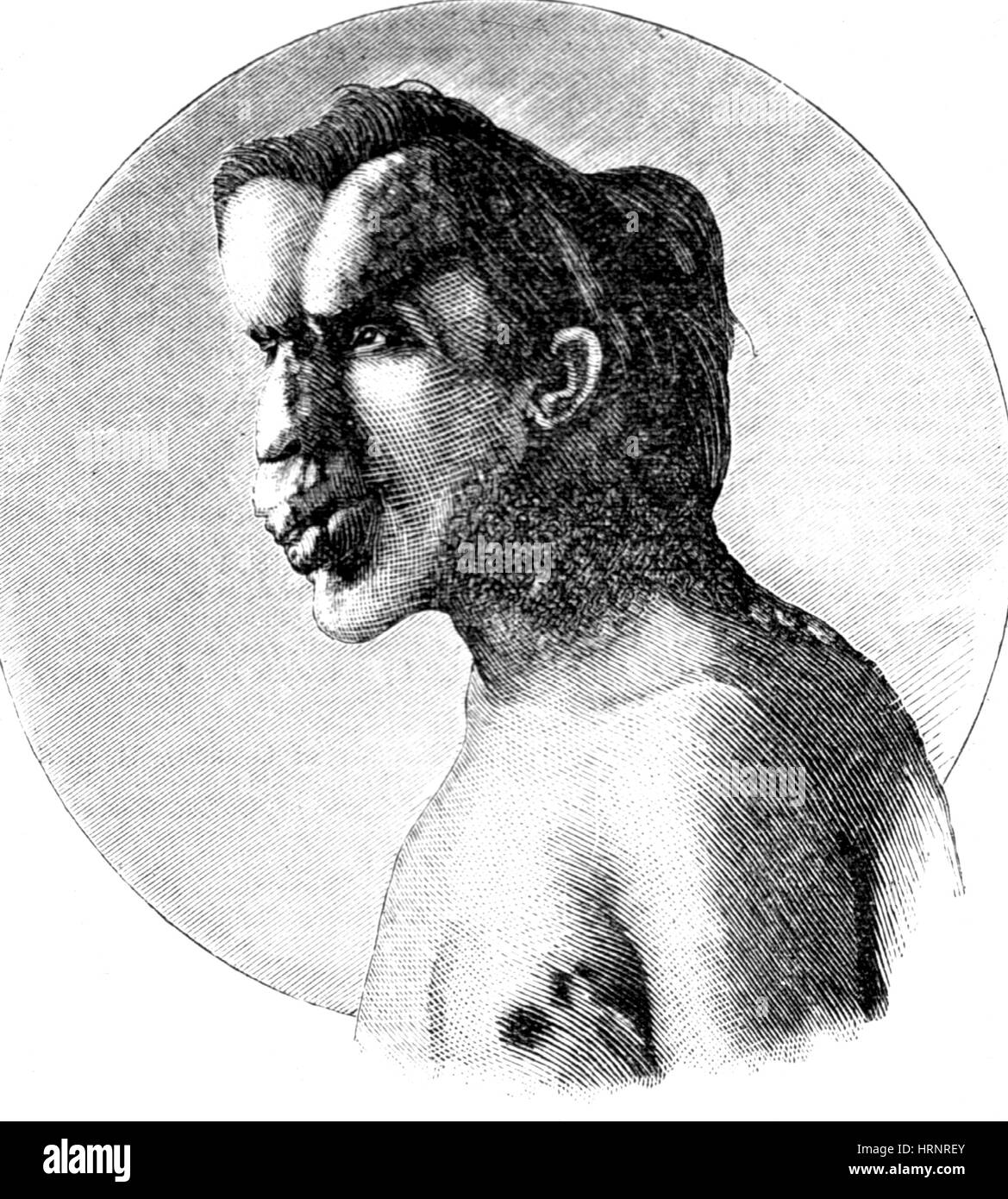 Joseph Merrick, The Elephant Man Photo Stock Alamy