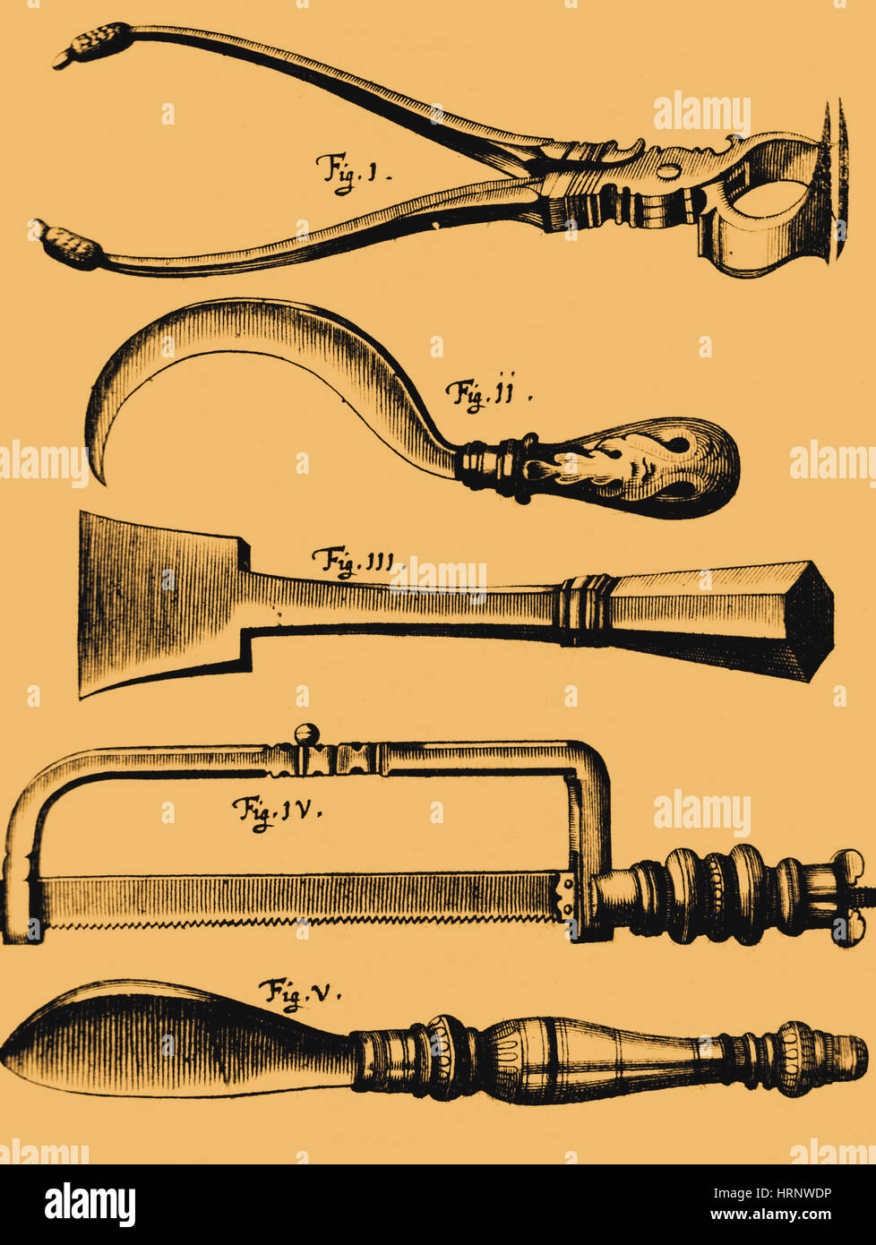 Instruments d'amputation, 1772 Banque D'Images