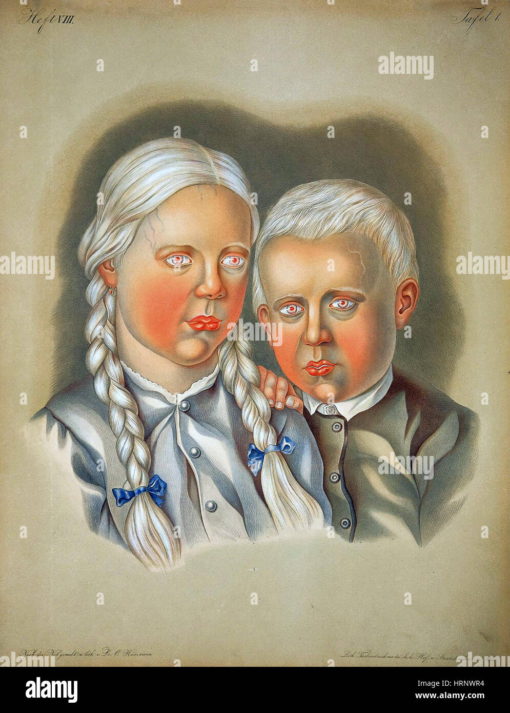 Les enfants albinos, 19e siècle Banque D'Images