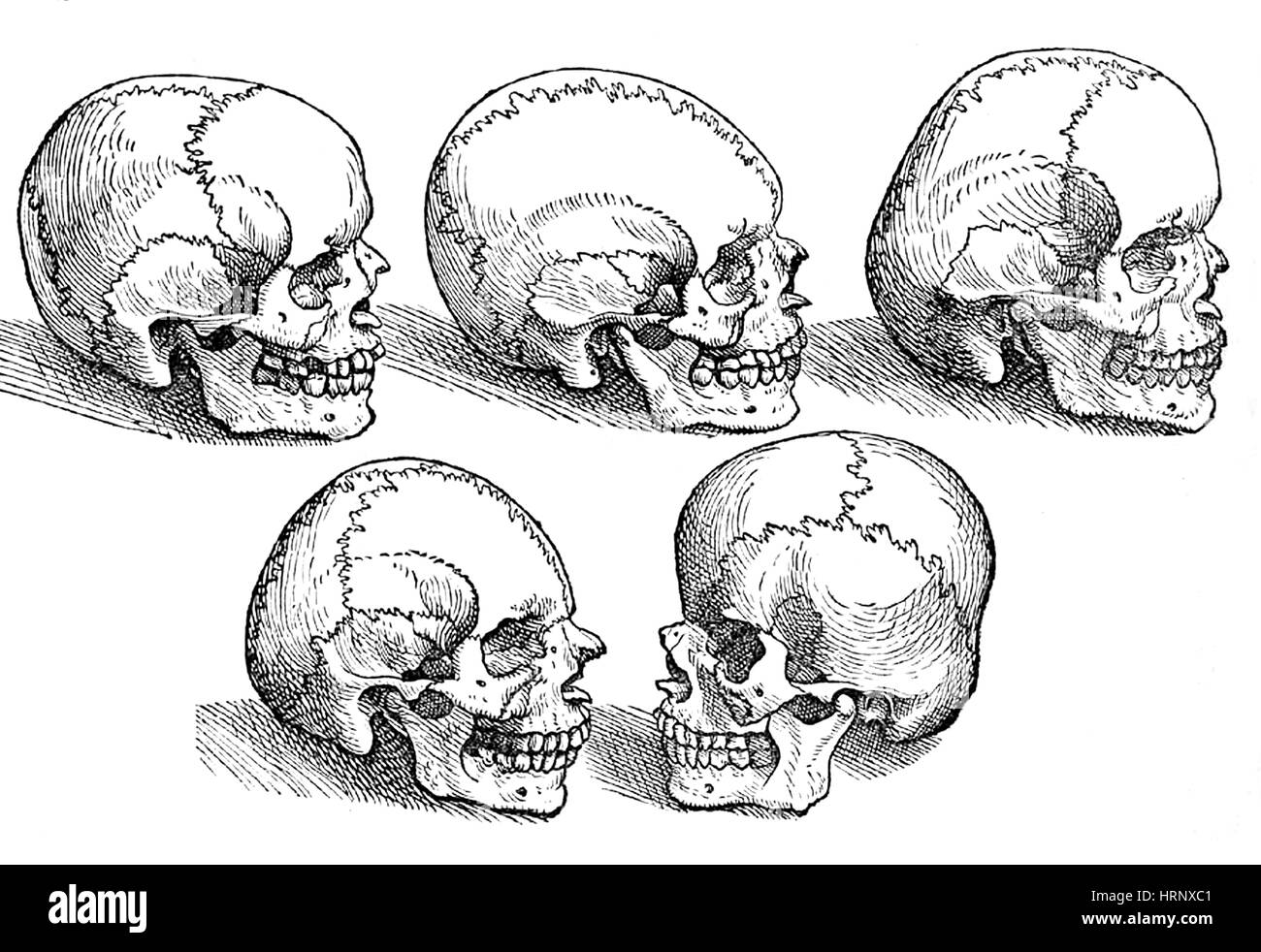 Crânes normaux et anormaux, 16e siècle Banque D'Images