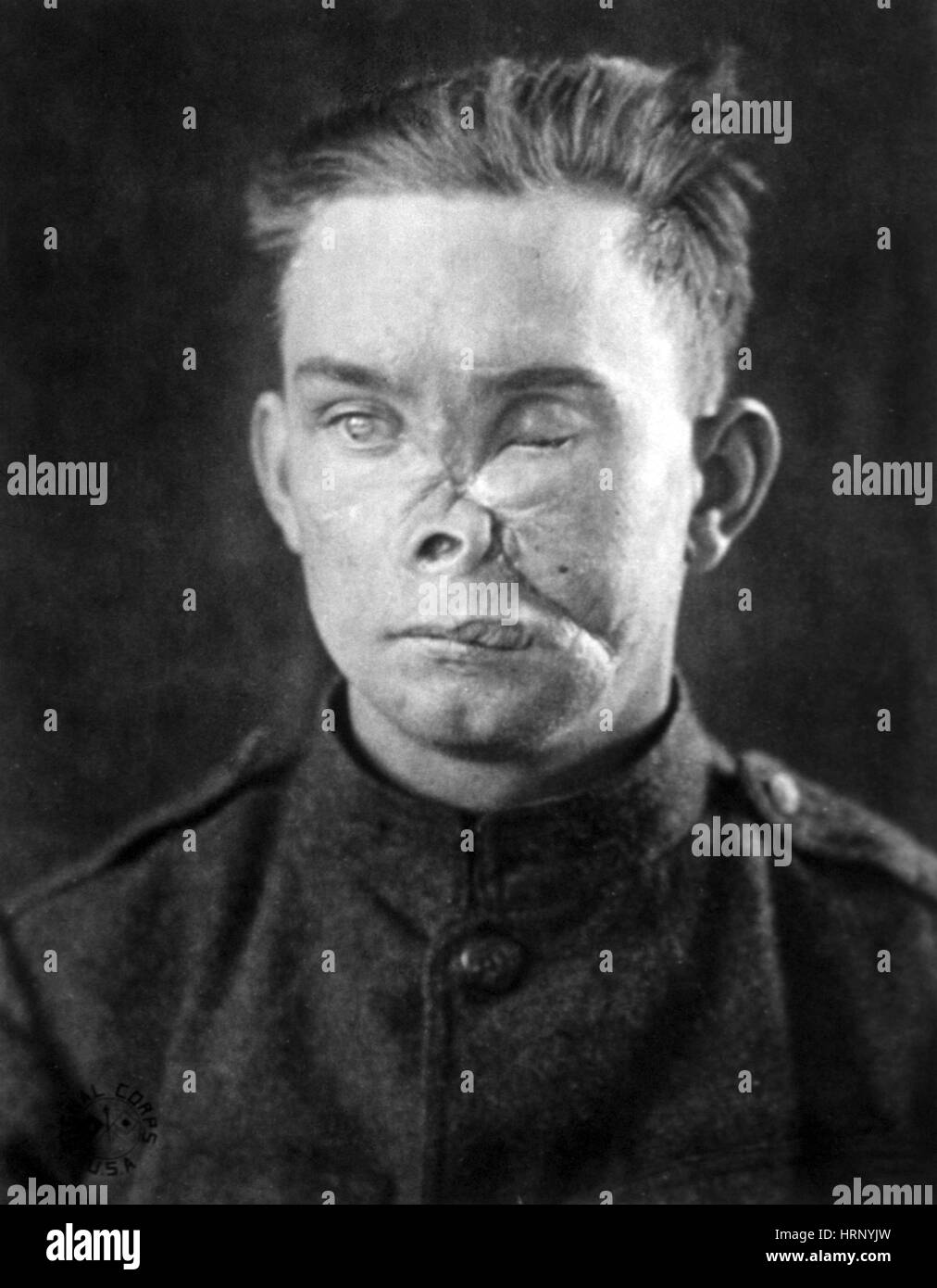 La première guerre mondiale, soldat blessé Banque D'Images