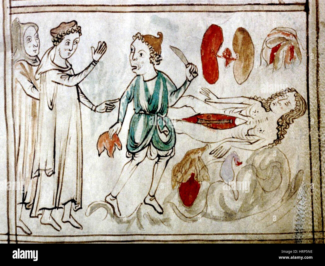 La dissection de cadavre, 13e siècle Banque D'Images