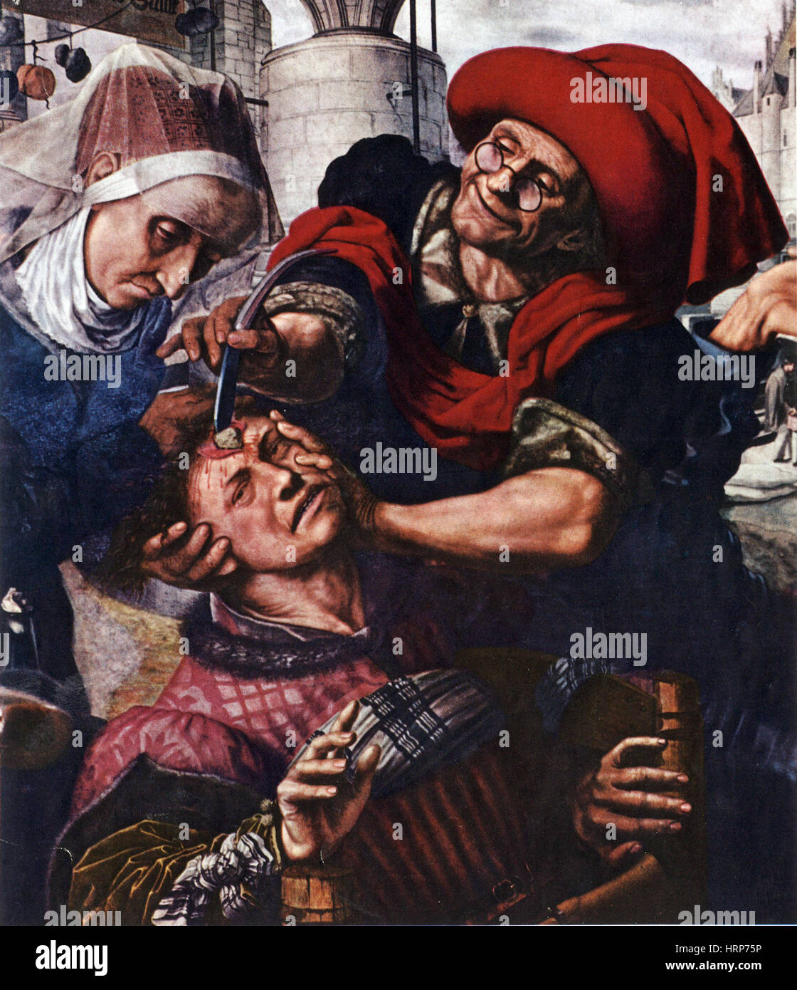 Barber-Surgeon traiter une blessure à la tête, 16e siècle Banque D'Images