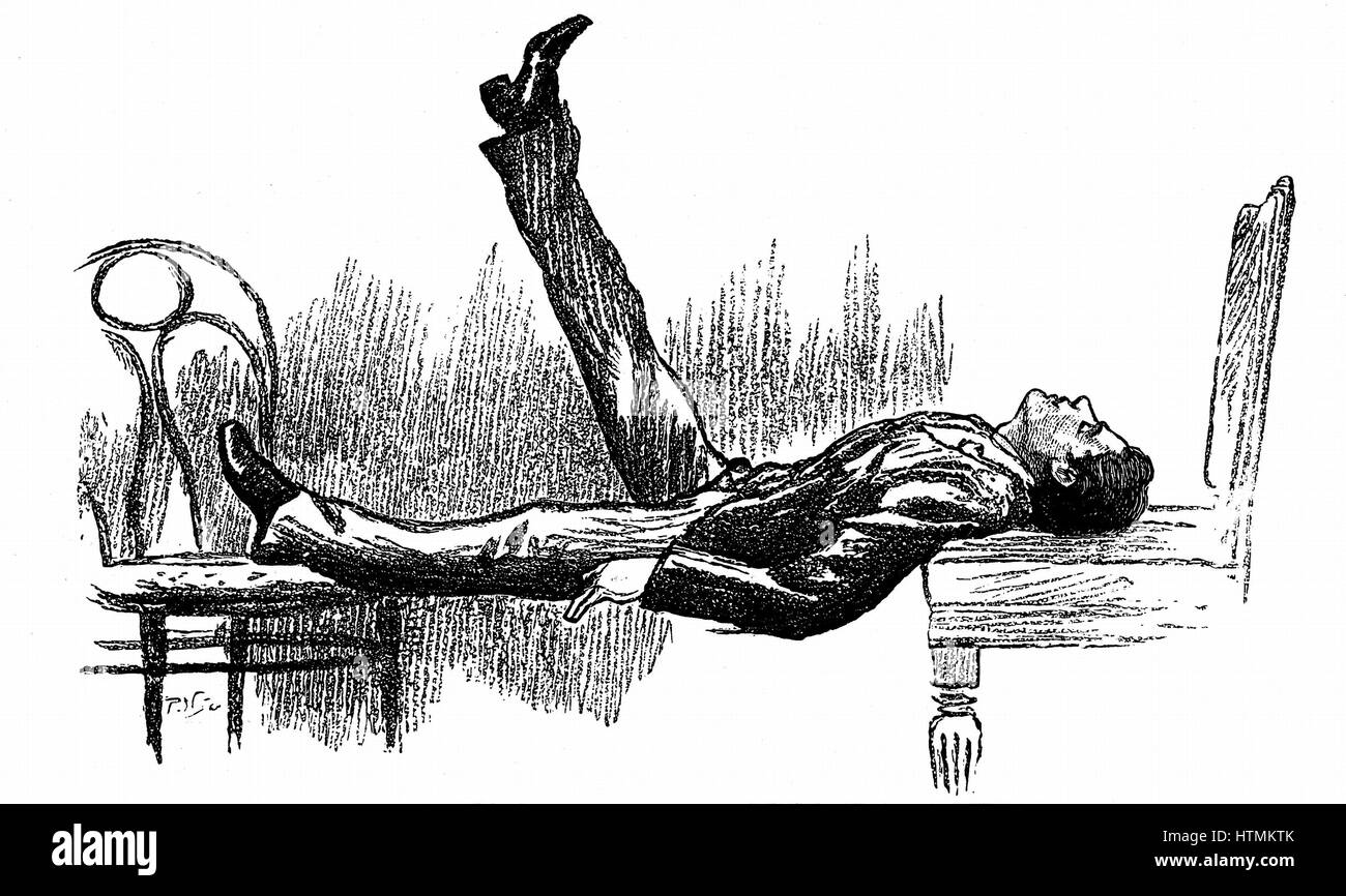 Exposition de l'hypnose donné par un médecin irlandais en utilisant le pseudonyme de 'Dr Stanley' à l'hôtel Metropole, Londres, sous les auspices des membres de la profession médicale. Objet dans un état de catalepsie. À partir de 'l'Illustrated London News, 1891. Utilisé les méthodes de Charcot Banque D'Images