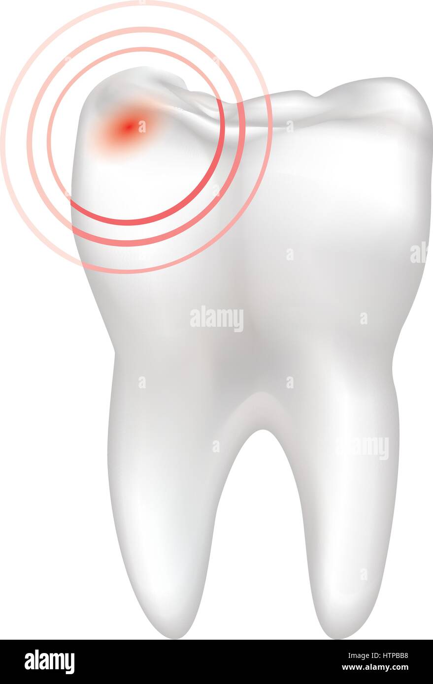 La douleur des dents isolées signe. les dents blanches signe. illustration médicale dentaire. Illustration de Vecteur