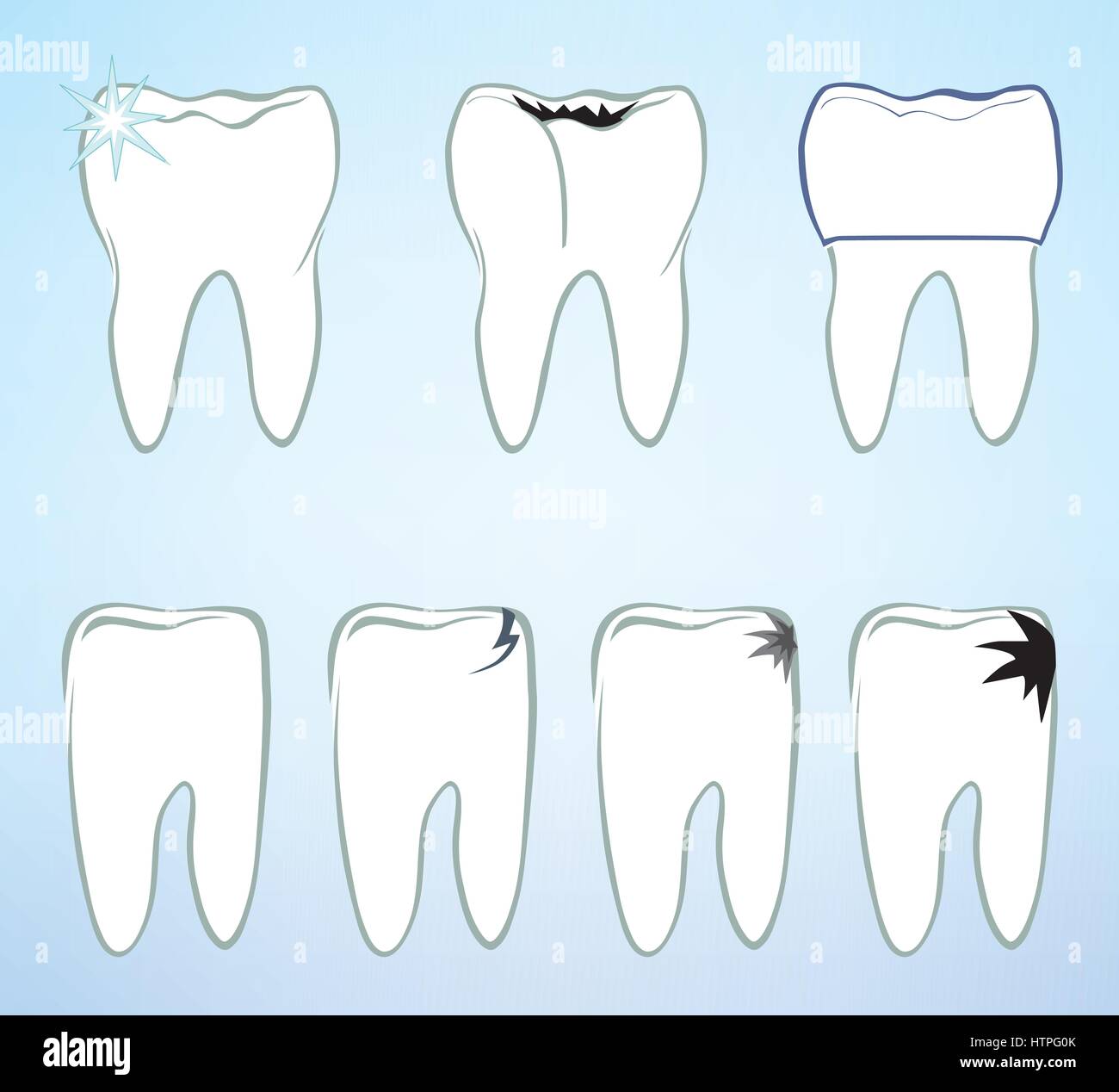 Jeu de dents. les dents blanches signe. médical dentaire colection isolés. Illustration de Vecteur