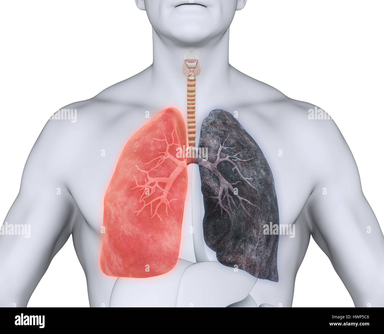 Poumon poumon sain et les fumeurs Banque D'Images