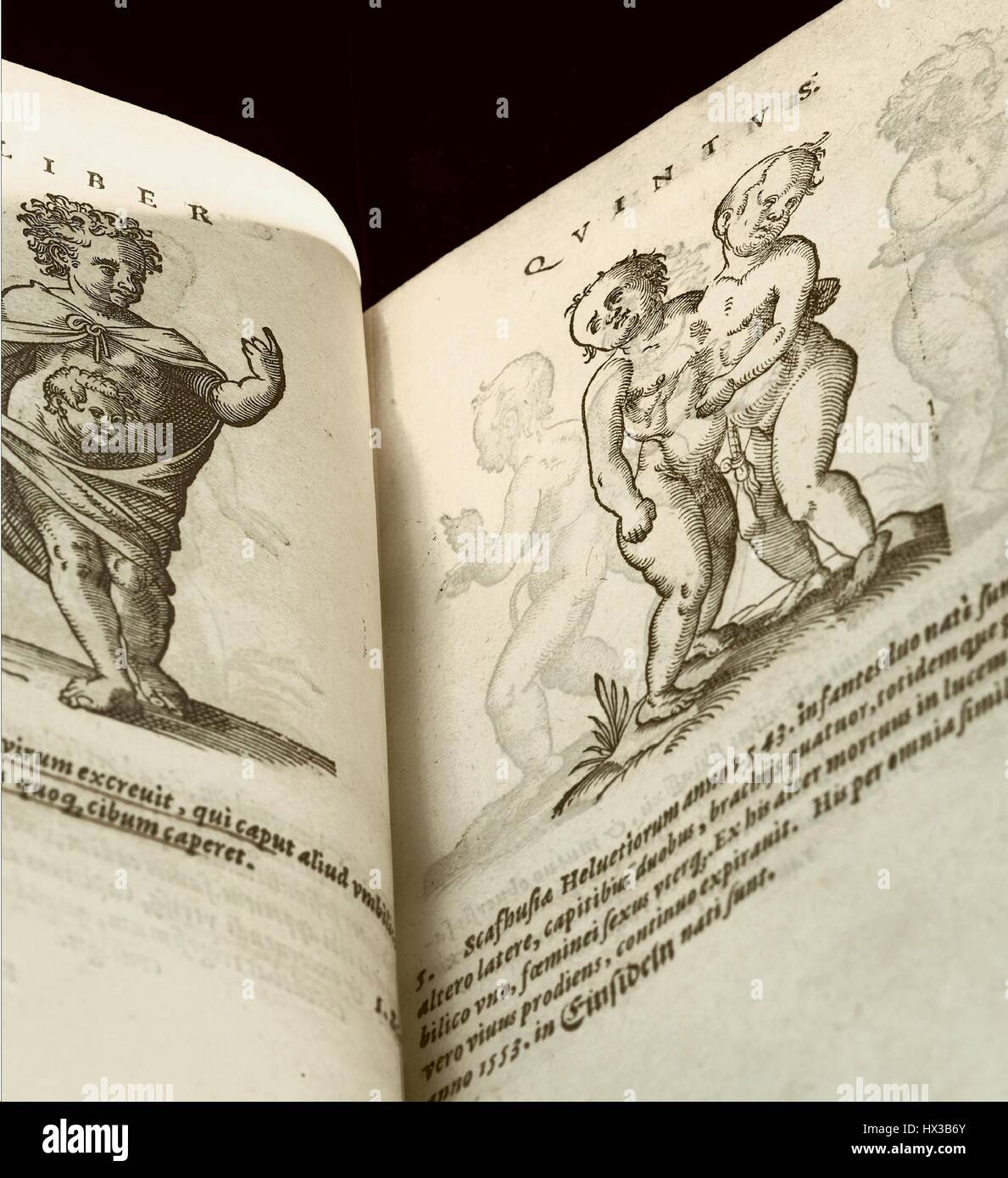 Deux pages face à face de De conceptu, et generatione hominis par Jakob Rueff (ca, 1560. 1500-1558), la gauche représentant un enfant né avec la tête de ses lits de plus en plus informes de son estomac, et le droit des jumeaux siamois né en Suisse en 1543. La permission de la National Library of Medicine. Banque D'Images
