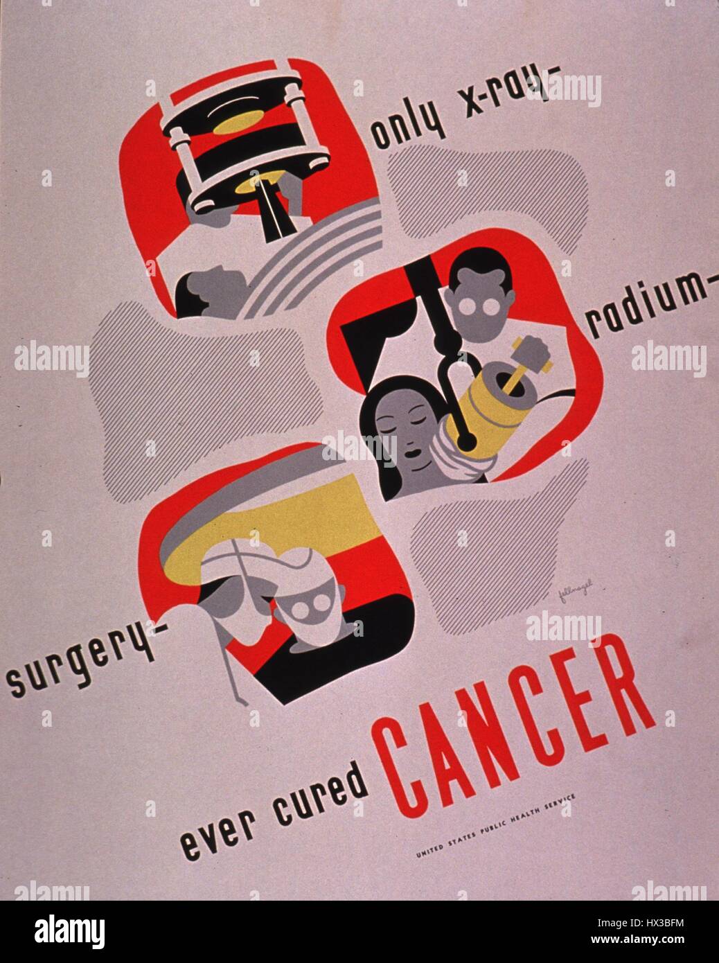 Affiche pour le 'x-ray chirurgie radium [qui] jamais guérir le cancer" de l'United States Public Health Service, 1930. La permission de la National Library of Medicine. Banque D'Images