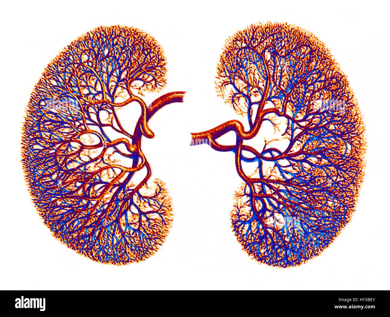 L'oeuvre de l'ordinateur de l'approvisionnement en sang pour les reins, montrant le dense réseau de capillaires résultant des divisions d'une artère rénale. Banque D'Images