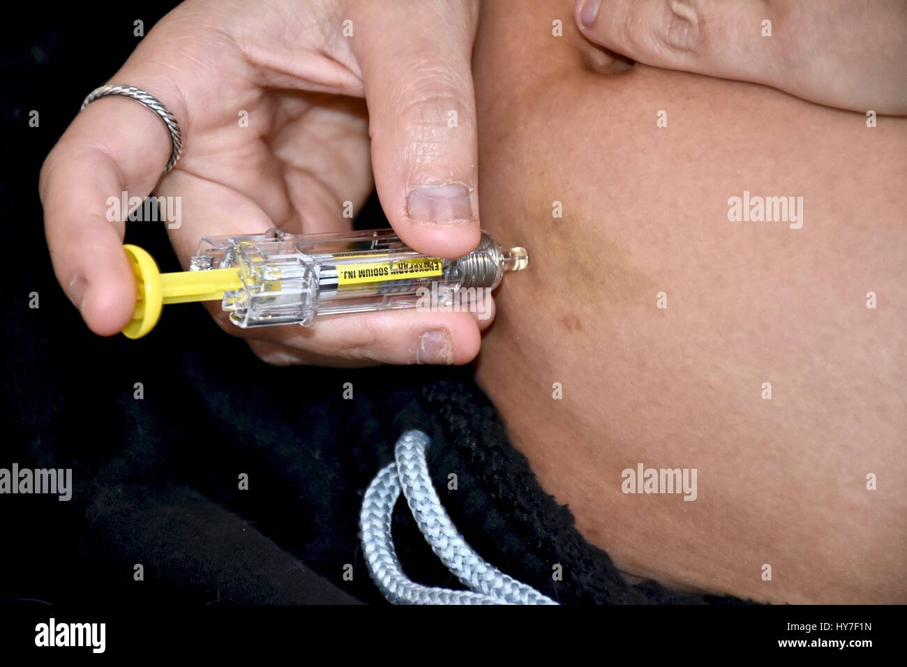 L'administration d'une injection sous-cutanée Banque D'Images