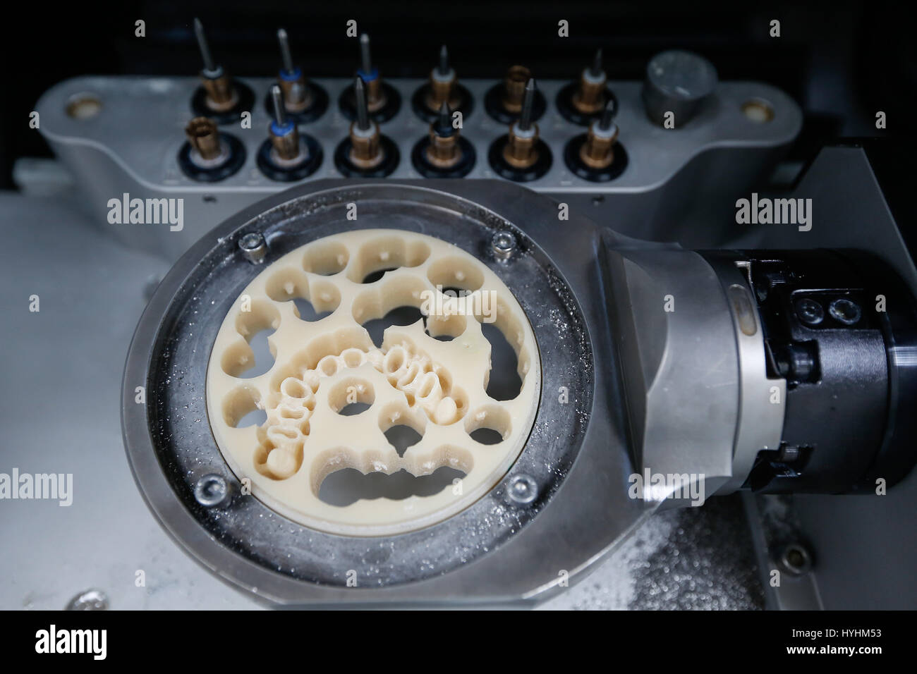 Implant de disque Banque de photographies et d’images à haute ...