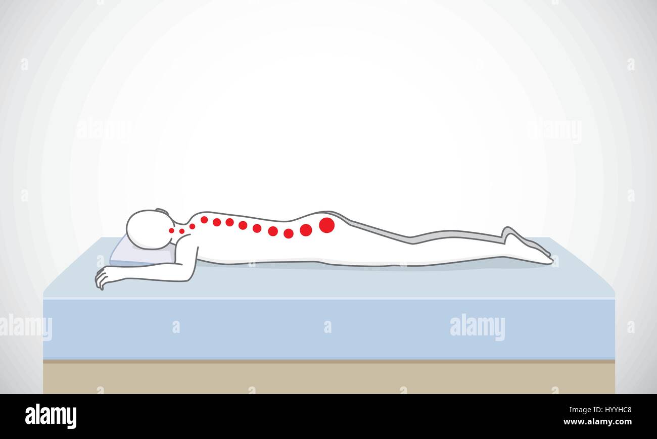 Prendre la mauvaise position de sommeil mauvais alignement de la colonne vertébrale. Illustration de Vecteur